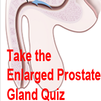 Prostate Quiz Featured